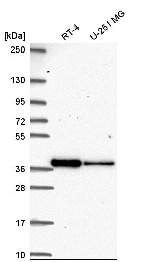 Anti-DTWD2 Antibody