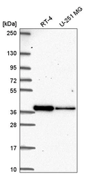 Anti-DTWD2 Antibody
