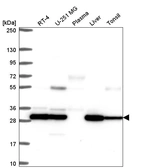 Anti-PSMB7 Antibody