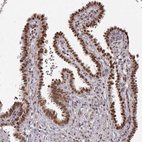 Anti-RAI1 Antibody