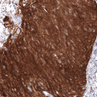 Anti-NCAM1 Antibody