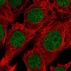 Immunofluorescent staining of human cell line MCF7 shows localization to nucleoplasm.