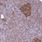 Anti-TRIM17 Antibody