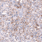 Anti-NCAM1 Antibody