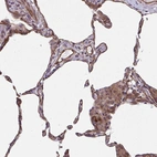 Anti-TNFSF10 Antibody