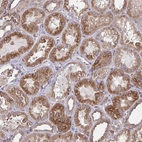 Immunohistochemical staining of human Kidney shows moderate membranous and cytoplasmic positivity in cells in tubules.