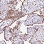 Anti-LPAR4 Antibody
