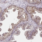 Immunohistochemical staining of human Prostate shows moderate membranous and cytoplasmic positivity in glandular cells.