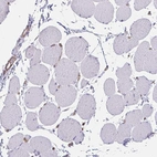 Immunohistochemical staining of human Skeletal muscle shows very weak membranous positivity in myocytes.