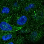 Immunofluorescent staining of human cell line RT4 shows localization to microtubules & cytokinetic bridge.