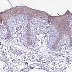 Immunohistochemical staining of human skin shows moderate cytoplasmic positivity in squamous epithelial cells.