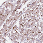 Immunohistochemical staining of human heart muscle show strong membranous and cytoplasmic positivity in intercalated disc in cardiomyocytes.