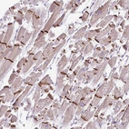 Immunohistochemical staining of human heart muscle show strong membranous and cytoplasmic positivity in intercalated disc in cardiomyocytes.