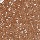 Immunohistochemical staining of human cerebral cortex shows strong positivity in neuropil.