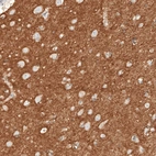 Immunohistochemical staining of human cerebral cortex shows strong positivity in neuropil.