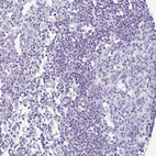 Immunohistochemical staining of human lymph node shows very weak positivity in non-germinal center cells.