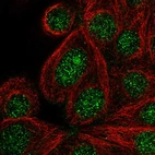 Immunofluorescent staining of human cell line MCF7 shows localization to nucleus & nucleoli.