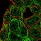 Immunofluorescent staining of human cell line RT4 shows localization to nucleoplasm & cytosol.