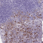 Anti-FASLG Antibody