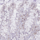 Immunohistochemical staining of human rectum shows moderate cytoplasmic positivity in lymphoid cells.