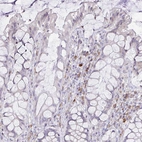 Immunohistochemical staining of human rectum shows moderate cytoplasmic positivity in lymphoid cells.