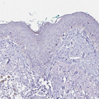 Immunohistochemical staining of human skin shows no positivity in squamous epithelial cells as expected.