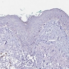 Immunohistochemical staining of human skin shows no positivity in squamous epithelial cells as expected.