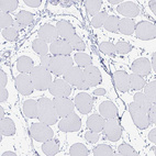 Immunohistochemical staining of human skeletal muscle shows no positivity in myocytes as expected.