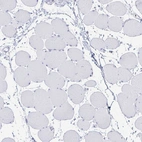 Immunohistochemical staining of human skeletal muscle shows no positivity in myocytes as expected.