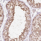 Anti-ZNF121 Antibody