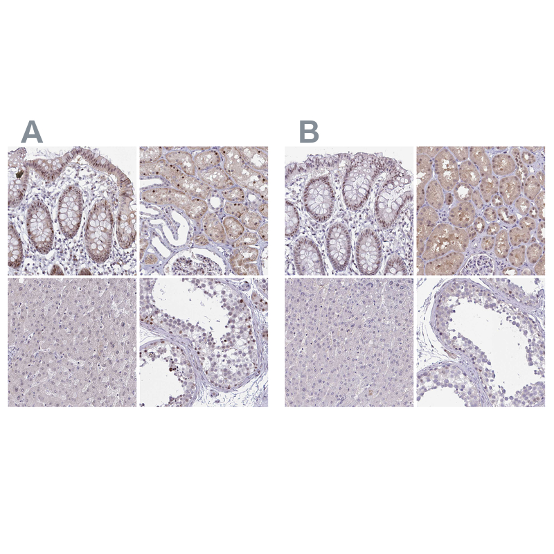 Anti-RBL1 Antibody
