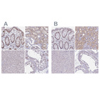 Anti-RBL1 Antibody