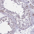 Immunohistochemical staining of human testis shows moderate nuclear positivity in cells in seminiferous ducts and Leydig cells.