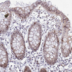Immunohistochemical staining of human colon shows moderate nuclear positivity in glandular cells.