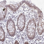 Immunohistochemical staining of human colon shows moderate nuclear positivity in glandular cells.