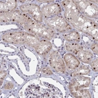Immunohistochemical staining of human kidney shows moderate nuclear positivity in cells in tubules.