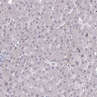 Immunohistochemical staining of human liver shows no positivity in hepatocytes as expected.