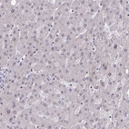Immunohistochemical staining of human liver shows no positivity in hepatocytes as expected.