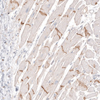 Immunohistochemical staining of human heart shows moderate positivity in the intercalated discs in cardiomyocytes.