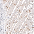 Immunohistochemical staining of human heart shows moderate positivity in the intercalated discs in cardiomyocytes.