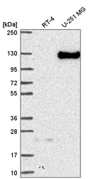 Western blot analysis in human cell line RT-4 and human cell line U-251 MG.