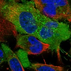 Immunofluorescent staining of human cell line U-251 MG shows localization to plasma membrane & vesicles.