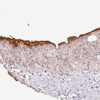 Anti-SLC29A3 Antibody