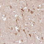 Immunohistochemical staining of human cerebral cortex shows moderate cytoplasmic positivity in neurons.