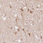 Immunohistochemical staining of human cerebral cortex shows moderate cytoplasmic positivity in neurons.