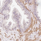 Immunohistochemical staining of human prostate shows moderate cytoplasmic positivity in smooth muscle cells.