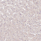 Immunohistochemical staining of human liver shows no positivity in hepatocytes as expected.