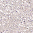 Anti-SLC29A3 Antibody