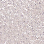 Immunohistochemical staining of human liver shows no positivity in hepatocytes as expected.