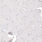 Immunohistochemical staining of human skeletal muscle shows no positivity in myocytes as expected.
